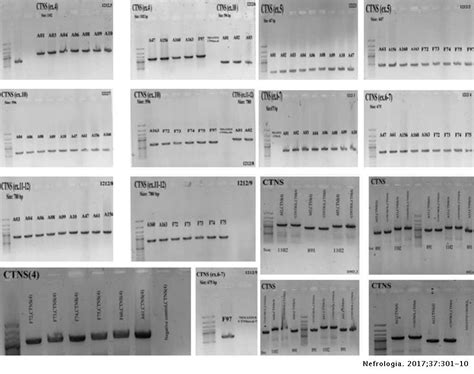 CTNS molecular genetics profile in a Persian nephropathic cystinosis population | Nefrología