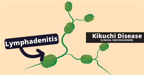 kikuchi-fujimoto disease Kikuchi-fujimoto disease - Diseases Club center