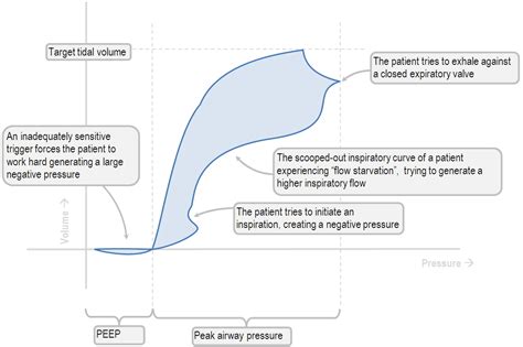 Pressure-volume loops in the presence of lung pathology - Deranged Physiology