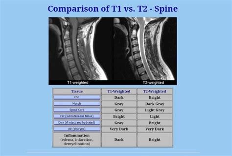 What is T1 and T2 in MRI?