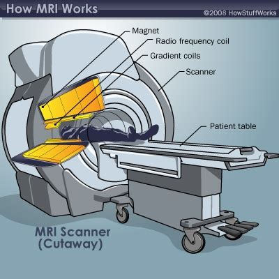 MRI Magnets: the Major Players - MRI Magnets | HowStuffWorks