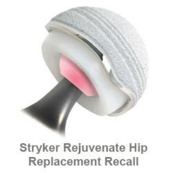 Hip Implant Settlement Proposal Announced On Stryker Rejuvenate and ...