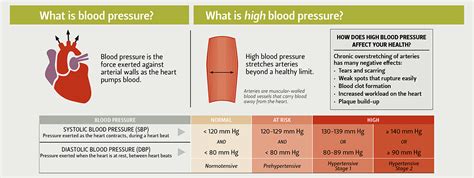 Arterial Thrombus Formation In High Blood Pressure – Beinyu.com