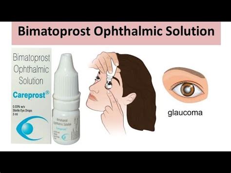 Bimatoprost Ophthalmic Solution | Bimatoprost eye Drops || use, side ...