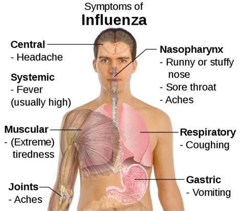 Symptoms - The Spanish Flu