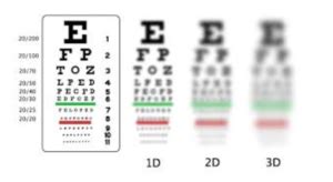 What is short-sightedness or myopia? - The Wimpole Eye Clinic