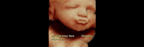 5D Ultrasound Photo Gallery: Cherish Every Detail | 3D 4D HD