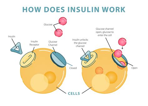 For Kids: What is Diabetes? - Children with Diabetes