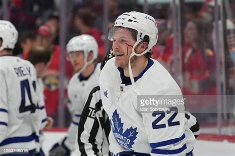 Toronto Maple Leafs defenseman Jake McCabe smiles and bleeds as he ...