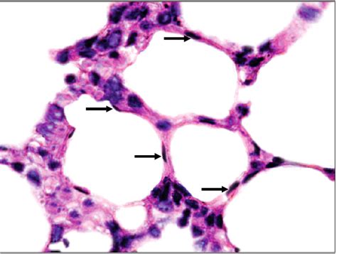 Lung Alveoli Histology