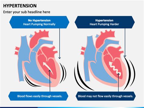 Free Hypertension PowerPoint and Google Slides Template - PPT Slides