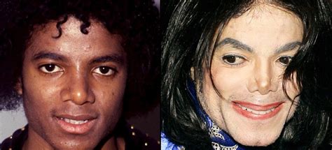 How did Michael Jackson change his skin color?