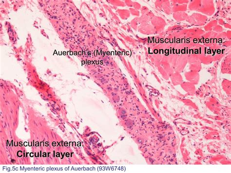 Block7/Fig. 5 Micrograph of Auerbach's (myenteric) plexus.