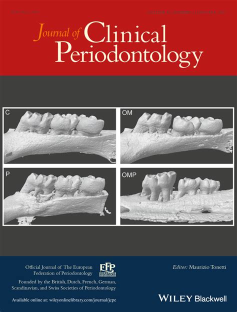 Journal of Clinical Periodontology : Vol 44 , No 1