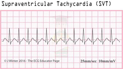 Pinterest | Ekg rhythms, Words, Word search puzzle