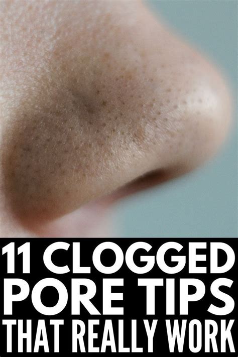 How to Get Rid of Clogged Pores: 11 Remedies & Products We Swear By ...