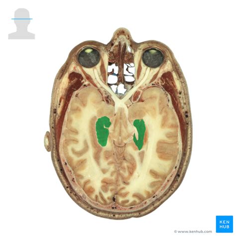 Dentate Gyrus - Anatomy | Kenhub