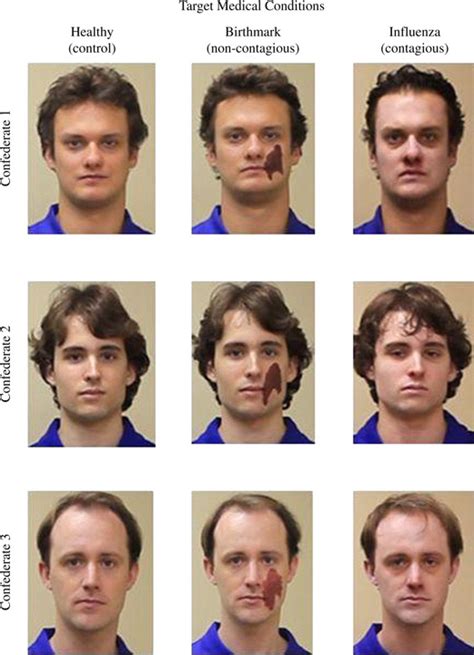 Why Facial Disfigurements Creep Us Out | Science | AAAS