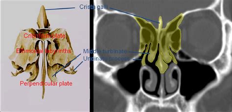 Ethmoid Anatomy