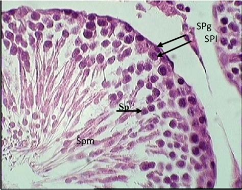 photomicrograph of Spermatogonia, Primary Spermatocyte, Spermatid and ...