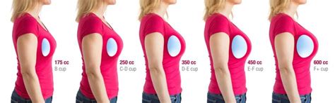 Which breast implants should I choose?