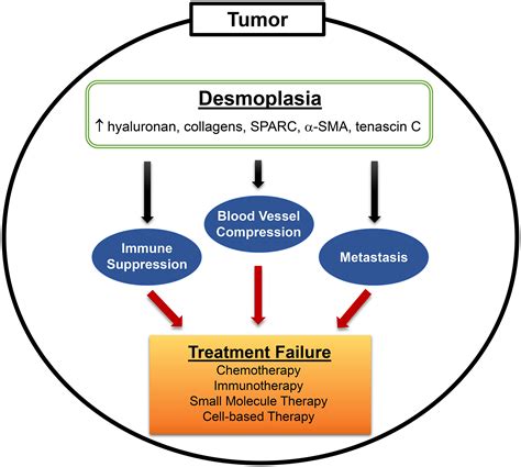 Targeting desmoplasia in pancreatic cancer as an essential first step to effective therapy ...