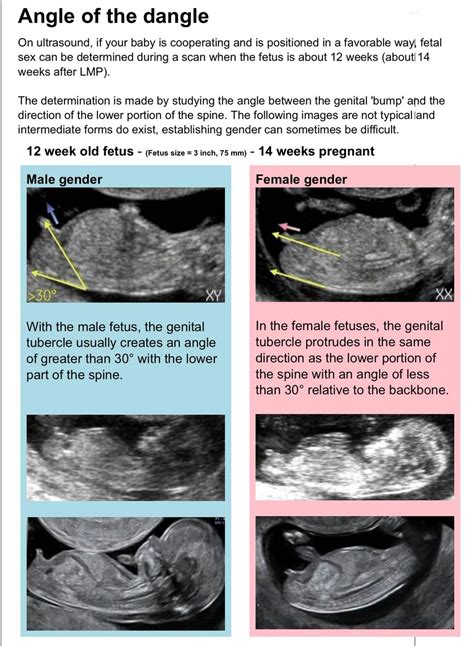 The dangle angle girl or boy | Baby gender prediction, Gender ...