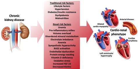 The Pathophysiology Of Hypertensive Acute Heart Failure Heart