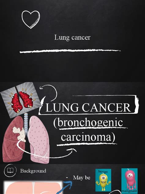 Lung Cancer | PDF | Lung Cancer | Cancer