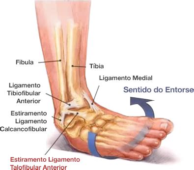 Ligamento Talofibular Anterior - Instituto Trata