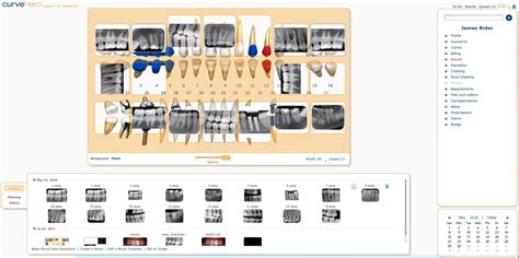 Curve Dental EHR Software | Free Demo, Pricing & Reviews 2024 | EMRFinder