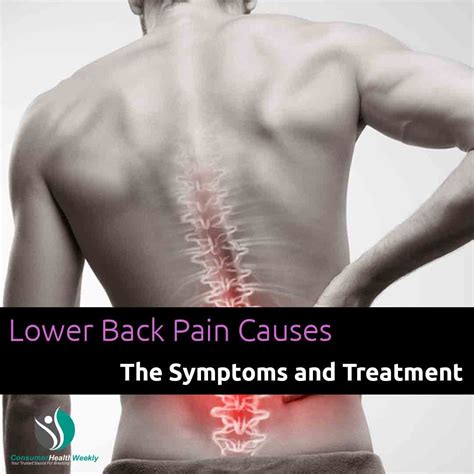 Can Lower Back Pain Cause Pain Behind Knee at Joseph Bowman blog