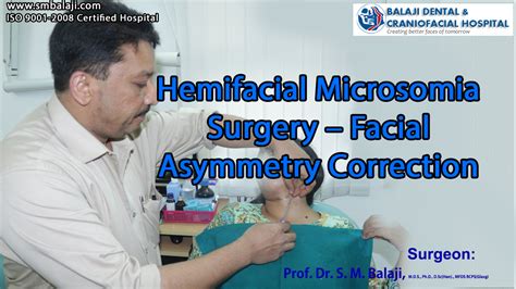 Hemifacial Microsomia Surgery – Facial Asymmetry Correction