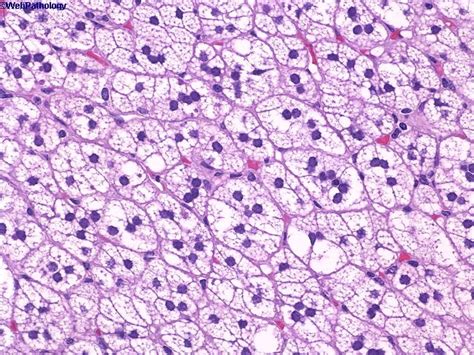 Zona Glomerulosa Histology