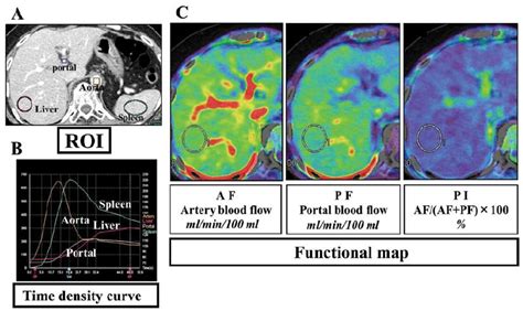 Imaging analysis of hepatic CT perfusion. In order to obtain perfusion... | Download Scientific ...