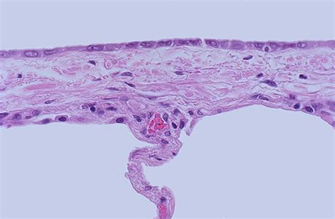 Parietal Pleura Histology