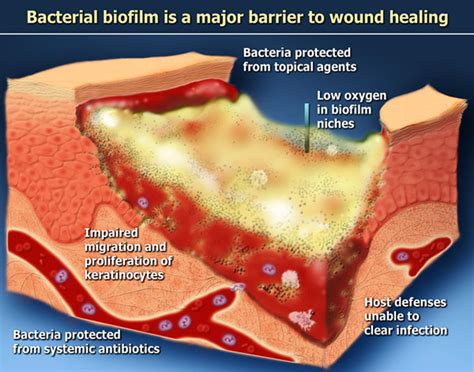 An overview of the normal skin healing process