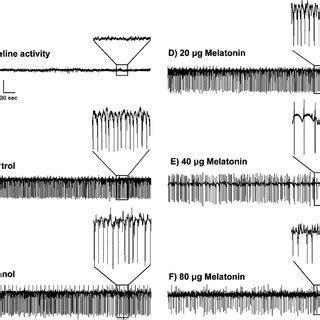 Representative ECoGs at 20–28 min after penicillin administration.... | Download Scientific Diagram