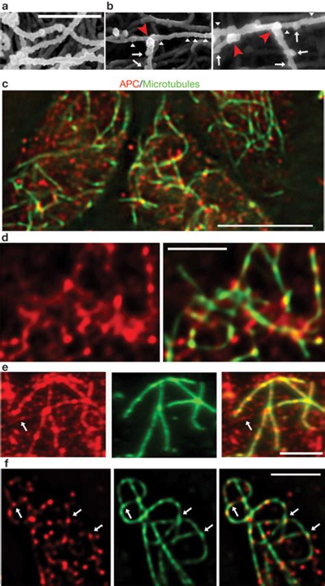 APC associates both with microtubules and the basal cortex.Scanning... | Download Scientific Diagram