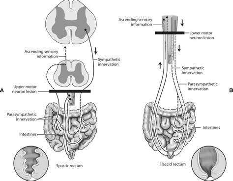 Upper Motor Neuron Pathway