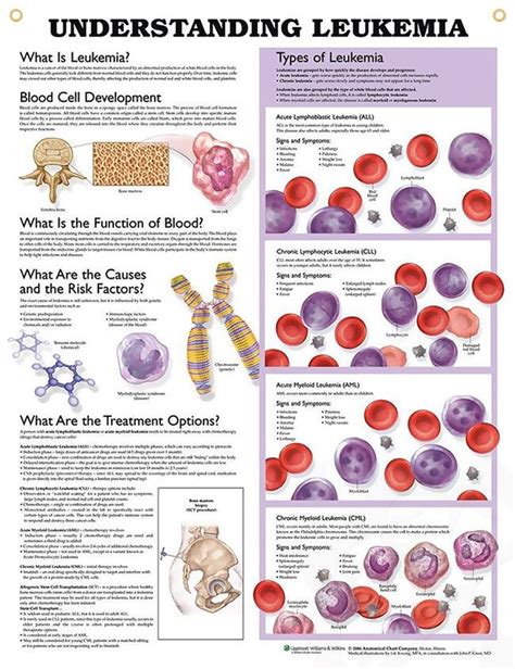 Understanding Leukemia anatomy poster for medical office and classroom ...