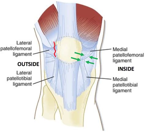 Patella Stabilisation — Sports Orthopaedic Centre