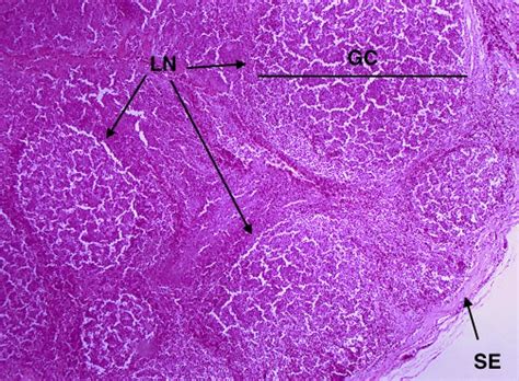 Palatine Tonsil 40x | Histology