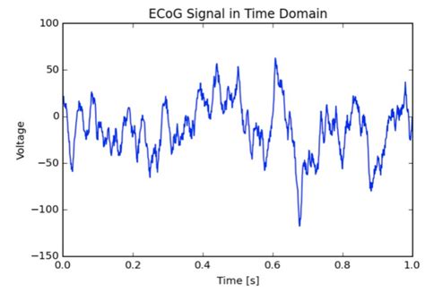 ECoG grid on cortical surface and ECoG signals. | Download Scientific Diagram