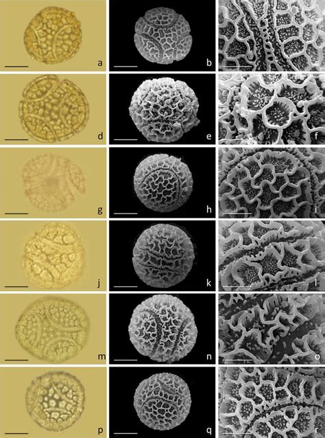 Figure 4-Pollen grains of Passiflora using a light microscope (LM)﻿ and ...