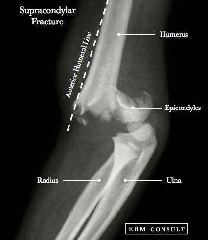 12 best X Rays & Radiology images on Pinterest | Rad tech, Radiology and Anatomy