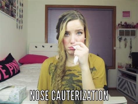 Nose Cauterization: My Experience - YouTube