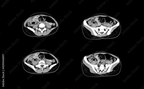 Abdomen ct scan and MRI professional images Stock Photo | Adobe Stock