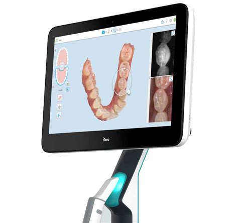 iTero Intraoral Scanning Solutions | Digital Dentistry | ZimVie