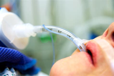 Preventing Medical Device-Related Pressure Injuries Preventing Medical Device-Related Pressure ...